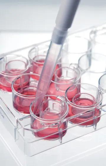 Cell culture insert for 12-well plates
PC-membrane, 0,4 µm, 4 x  9, pack of 36