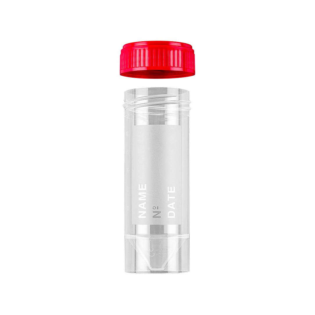 Сад за урина нестерилен 30 ml